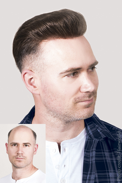 Men's Hair Replacement Systems at Simon Constantinou Award-winning Cardiff Barbers