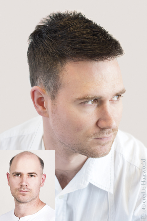 Men's hair replacement system - at Simon Constantinou Hair System Specialists - Cardiff