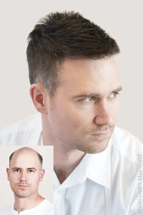Men's Hair Replacement Systems |Hair Loss Solutions at Simon Constantinou's  Cardiff Salon |