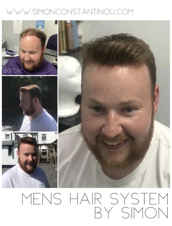 Men’s Hair Replacement Systems Hair Loss Solutions at Simon Constantinou’s Cardiff Salon