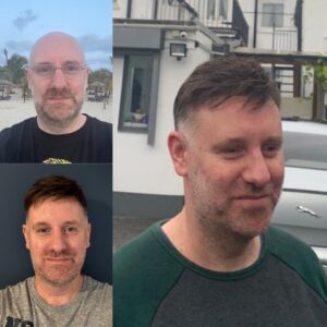 Mens Hair Replacement System by Simon Constantinou, Hair Replacement Specialist, Cardiff