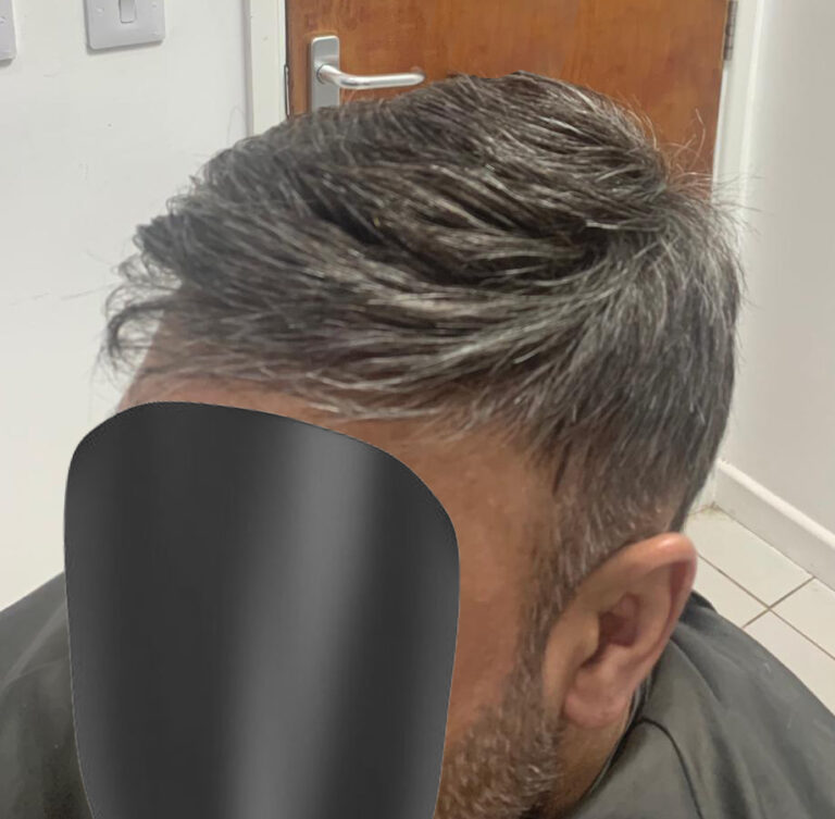 Mens Hair System by Simon Constantinou WIg Fitters Cardiff