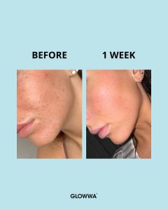 Glowwa Collagen skin results - before and after. Available to buy at Simon Constantinou Hairdressers Cardiff